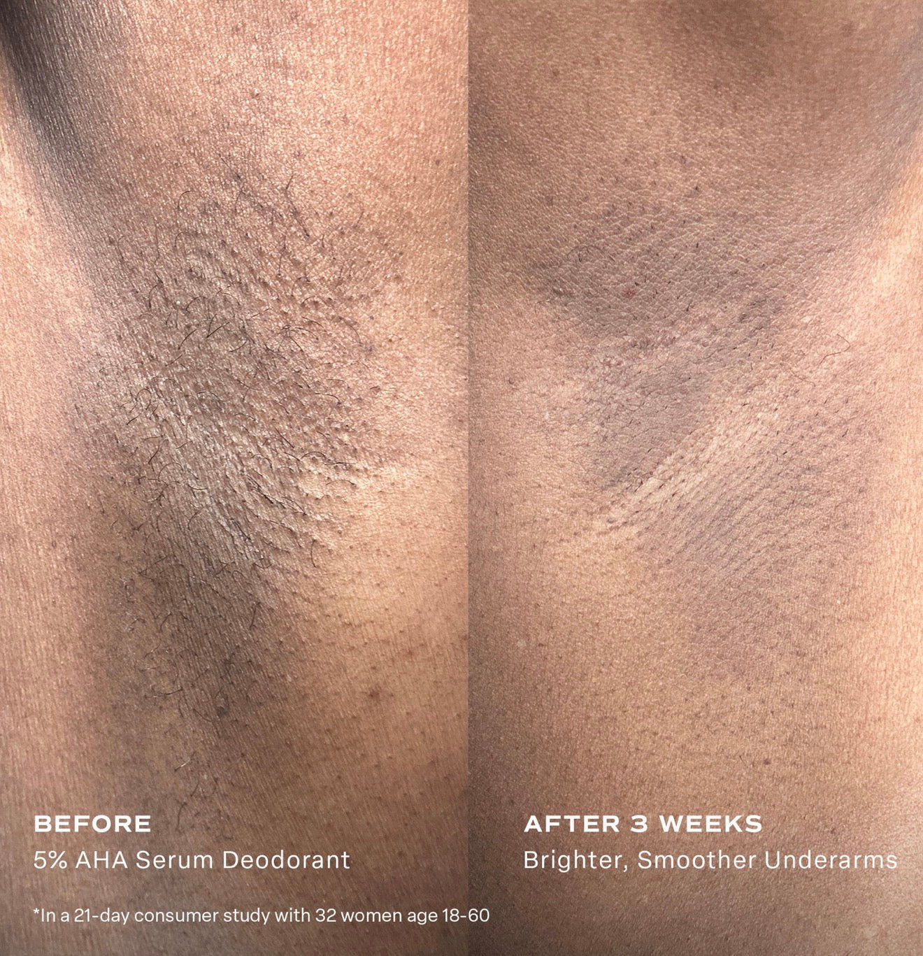 SALTAIR 5% AHA SERUM DEODORANT