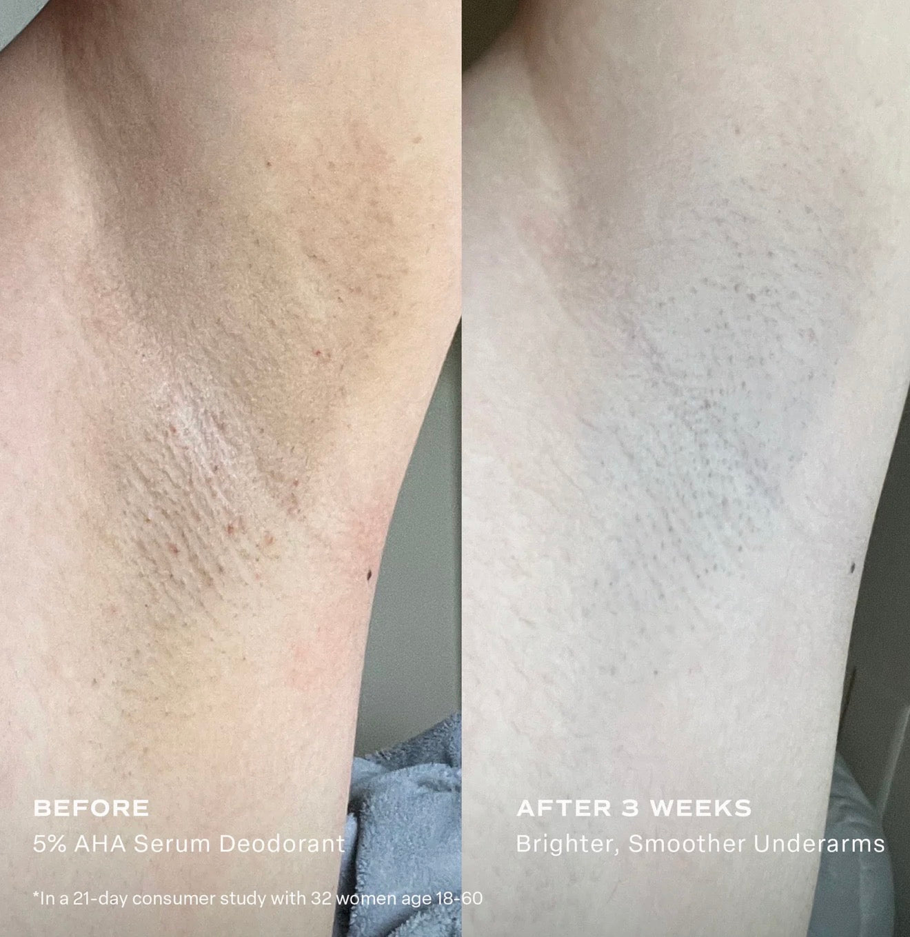 SALTAIR 5% AHA SERUM DEODORANT