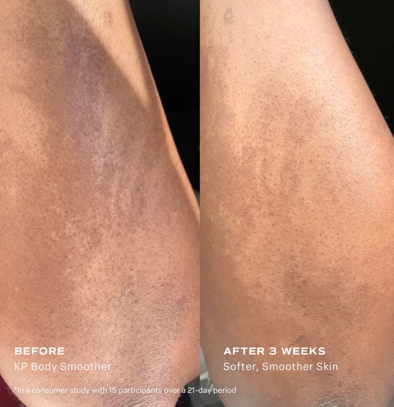 SALTAIR KP BODY SMOOTHER
EXFOLIATING MILK